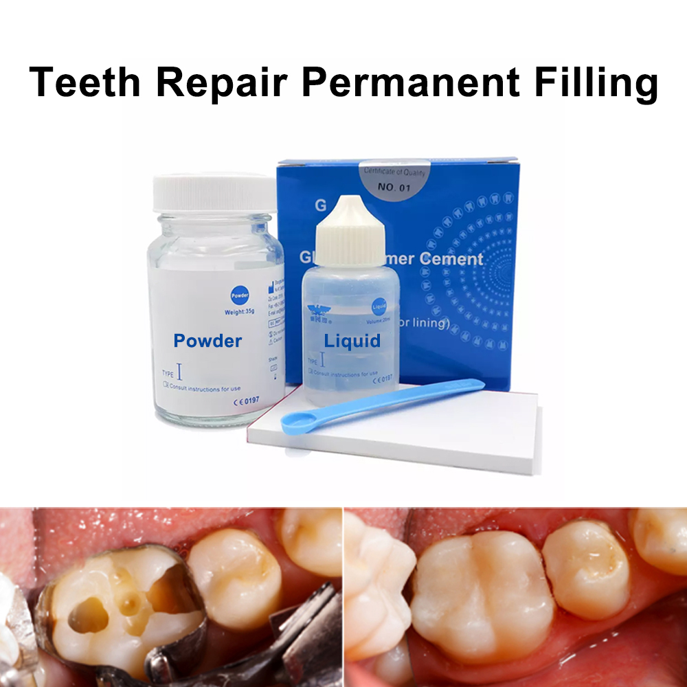 Teeth Whitening At Home Kit - Kit de reparo permanente para enchimento