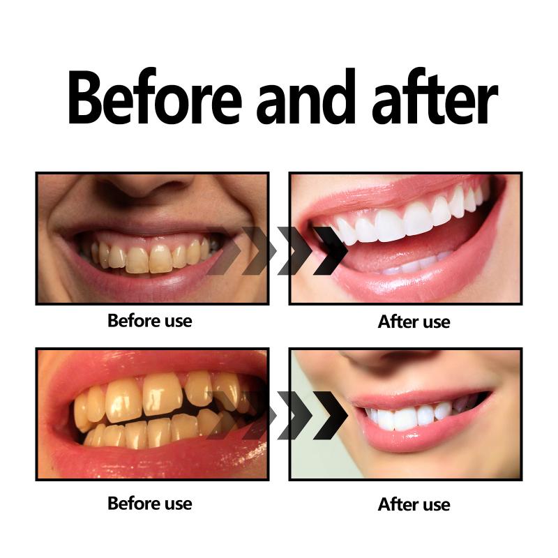 Esquivo dental em pó carvão/so - Teeth Whitening Baking Soda avaliação e preço