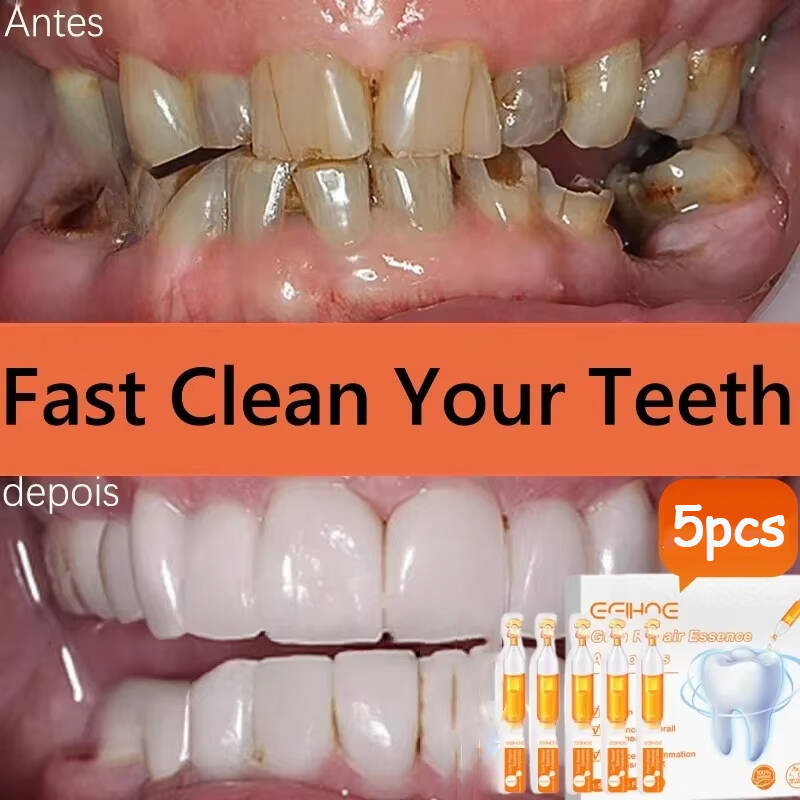 Soro de goma para reparação rá - Teeth Whitening Baking Soda avaliação e preço