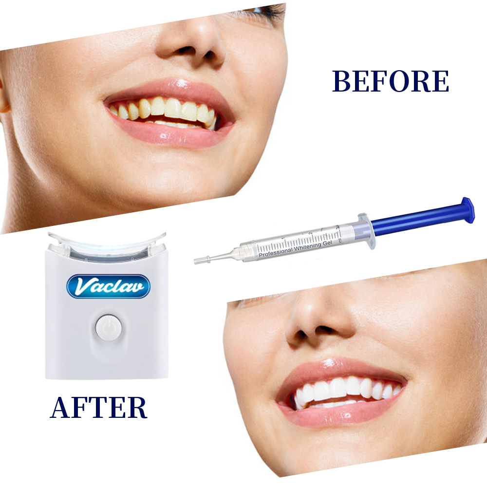 Seringa de gel para clareament - Teeth Whitening Baking Soda avaliação e preço
