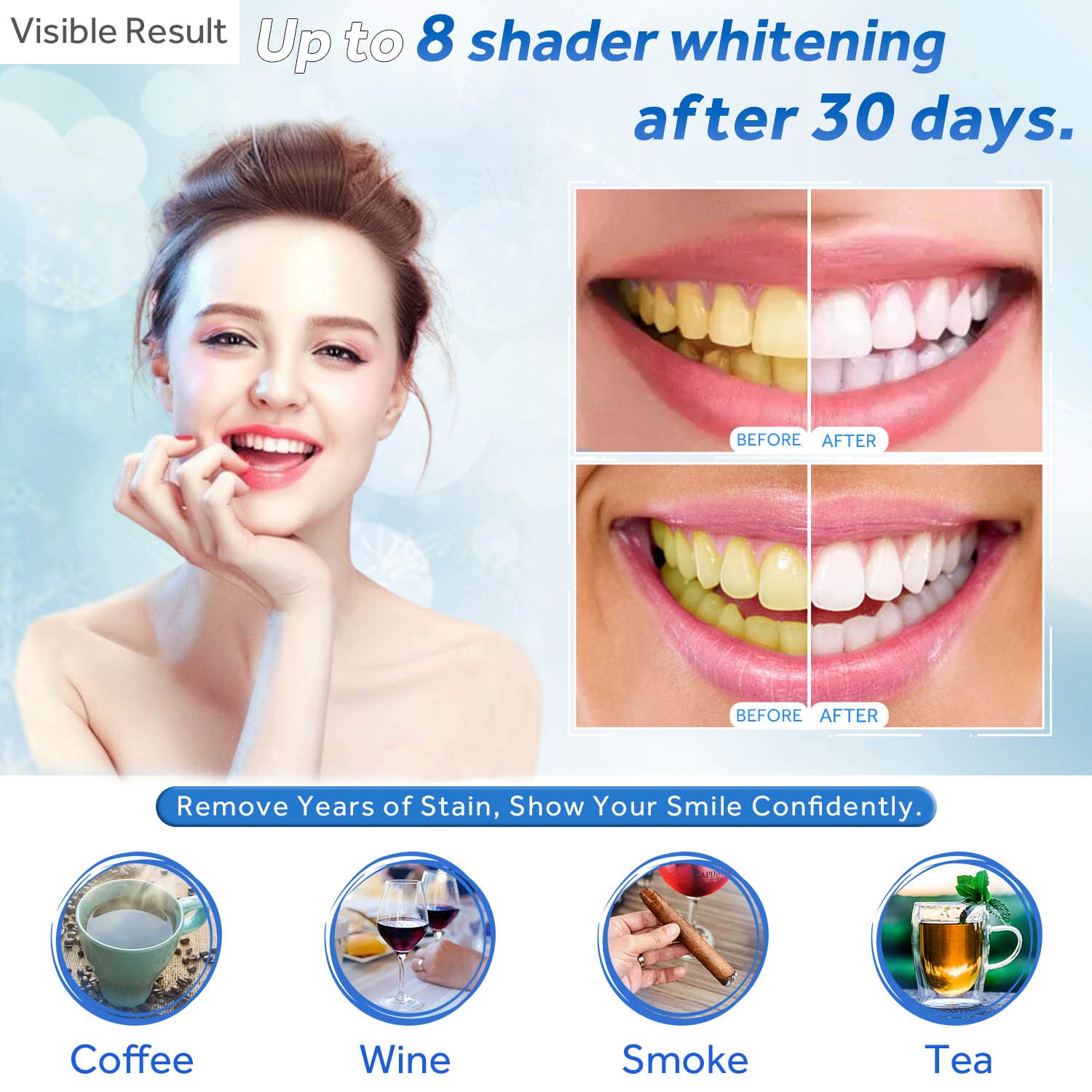 Seringa de recarga de gel para - Teeth Whitening App avaliação e preço