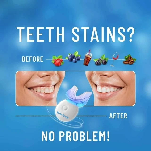 Kit de Limpeza de Alta Qualida - Teeth Whitening At Home Kit avaliação e preço