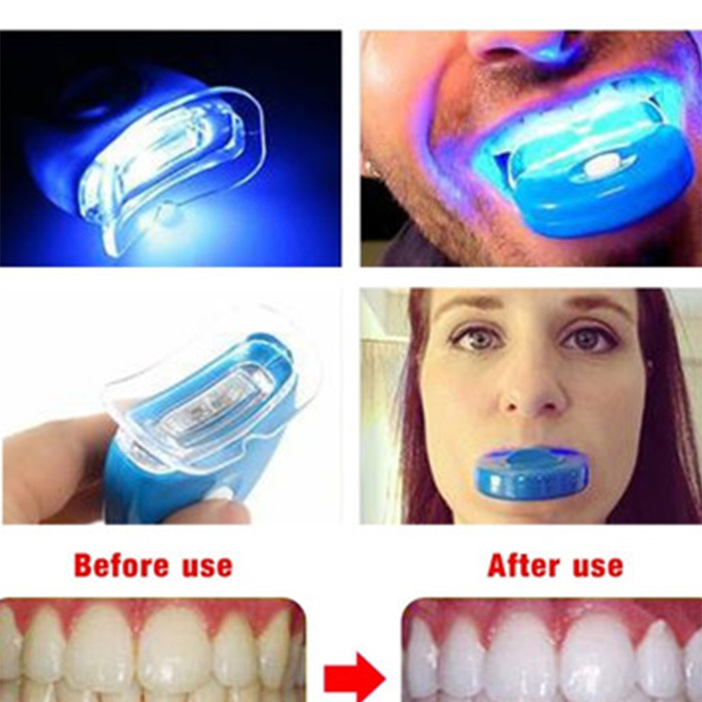 Acelerador de clareamento dent - Teeth Whitening With Laser avaliação e preço