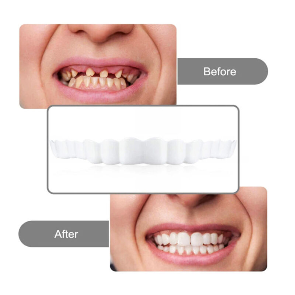 Conjunto de Dentaduras 2026ico - Teeth Whitening Usa avaliação e preço